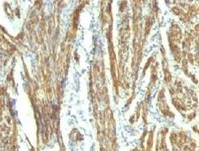 CALD1 / Caldesmon Antibody - Formalin-fixed, paraffin-embedded human uterus stained with CAD antibody (CALD1/820 + h-CALD).  This image was taken for the unmodified form of this product. Other forms have not been tested.