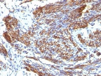 CALD1 / Caldesmon Antibody - Formalin-fixed, paraffin-embedded human uterus stained with CAD antibody (CALD1/820).  This image was taken for the unmodified form of this product. Other forms have not been tested.