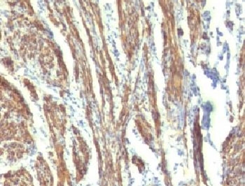CALD1 / Caldesmon Antibody - IHC testing of FFPE human uterus with CAD antibody (clone CDSM-3).  This image was taken for the unmodified form of this product. Other forms have not been tested.