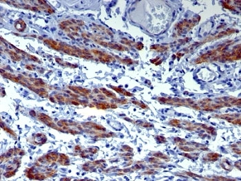 CALD1 / Caldesmon Antibody - Formalin-fixed, paraffin-embedded human uterus stained with CAD antibody (h-CALD).  This image was taken for the unmodified form of this product. Other forms have not been tested.