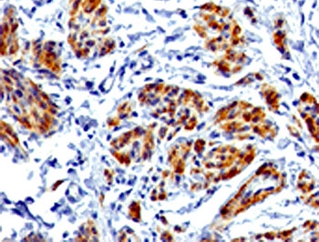CALD1 / Caldesmon Antibody - Formalin-fixed, paraffin-embedded human uterus stained with CAD antibody (CALD1/820).  This image was taken for the unmodified form of this product. Other forms have not been tested.