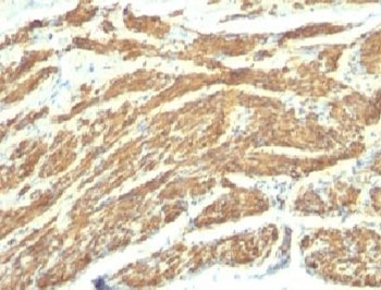 CALD1 / Caldesmon Antibody - Formalin-fixed, paraffin-embedded human uterus stained with Caldesmon antibody (SPM168).  This image was taken for the unmodified form of this product. Other forms have not been tested.