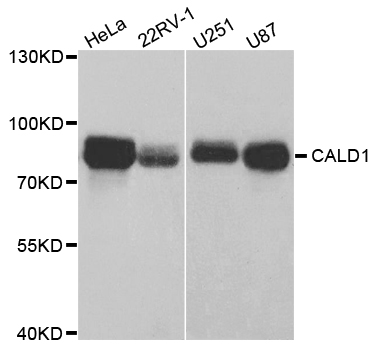 CALD1 / Caldesmon Antibody - Western blot analysis of extracts of various cell lines.