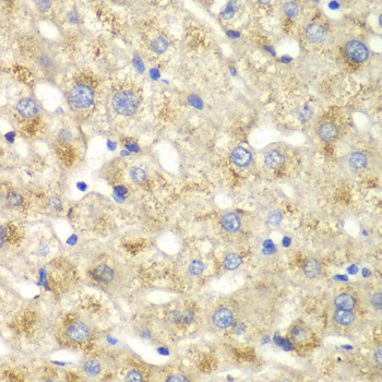 CALD1 / Caldesmon Antibody - Immunohistochemistry of paraffin-embedded human liver injury tissue.