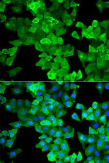 CALD1 / Caldesmon Antibody - Immunofluorescence analysis of A549 cells.