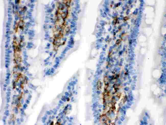 CALD1 / Caldesmon Antibody - Caldesmon was detected in paraffin-embedded sections of rat intestine tissues using rabbit anti-Caldesmon Antigen Affinity purified polyclonal antibody at 1 µg/mL. The immunohistochemical section was developed using SABC method
