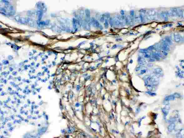 CALD1 / Caldesmon Antibody - Caldesmon was detected in paraffin-embedded sections of human intestinal tissues using rabbit anti-Caldesmon Antigen Affinity purified polyclonal antibody at 1 ug/ml. The immunohistochemical section was developed using SABC method