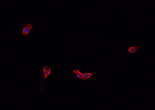 CALD1 / Caldesmon Antibody - Staining HeLa cells by IF/ICC. The samples were fixed with PFA and permeabilized in 0.1% Triton X-100, then blocked in 10% serum for 45 min at 25°C. The primary antibody was diluted at 1:200 and incubated with the sample for 1 hour at 37°C. An Alexa Fluor 594 conjugated goat anti-rabbit IgG (H+L) antibody, diluted at 1/600, was used as secondary antibody.