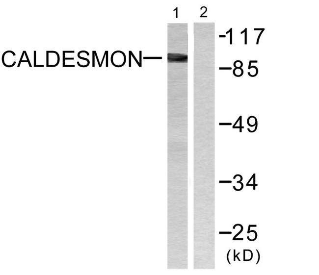 CALD1 / Caldesmon Antibody - Western blot analysis of extracts from HeLa cells, treated with EGF (200ng/ml, 30mins), using Caldesmon (Ab-789) antibody.