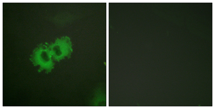 CALD1 / Caldesmon Antibody - Immunofluorescence analysis of HeLa cells, using Caldesmon (Phospho-Ser789) Antibody. The picture on the right is blocked with the phospho peptide.