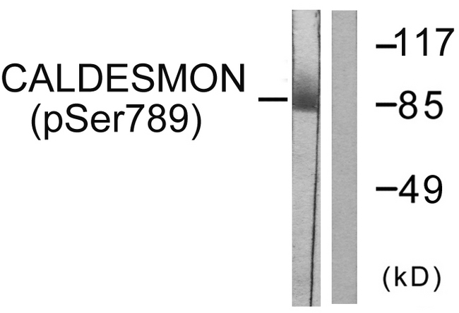 CALD1 / Caldesmon Antibody - Western blot analysis of lysates from HeLa cells treated with EGF 200ng/ml 30', using Caldesmon (Phospho-Ser789) Antibody. The lane on the right is blocked with the phospho peptide.