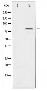 CALD1 / Caldesmon Antibody - Western blot of Caldesmon phosphorylation expression in EGF treated HeLa whole cell lysates,The lane on the left is treated with the antigen-specific peptide.
