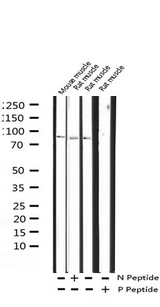 CALD1 / Caldesmon Antibody - Western blot analysis of Phospho-Caldesmon (Ser789) expression in various lysates