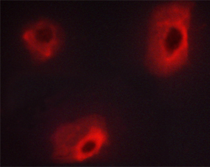 CALD1 / Caldesmon Antibody - Staining HeLa cells by IF/ICC. The samples were fixed with PFA and permeabilized in 0.1% saponin prior to blocking in 10% serum for 45 min at 37°C. The primary antibody was diluted 1/400 and incubated with the sample for 1 hour at 37°C. A Alexa Fluor 594 conjugated goat polyclonal to rabbit IgG (H+L), diluted 1/600 was used as secondary antibody.