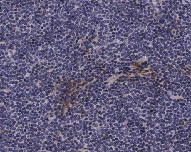 CALD1 / Caldesmon Antibody - 1:200 staining human lymph nodes tissue by IHC-P. The tissue was formaldehyde fixed and a heat mediated antigen retrieval step in citrate buffer was performed. The tissue was then blocked and incubated with the antibody for 1.5 hours at 22°C. An HRP conjugated goat anti-rabbit antibody was used as the secondary.