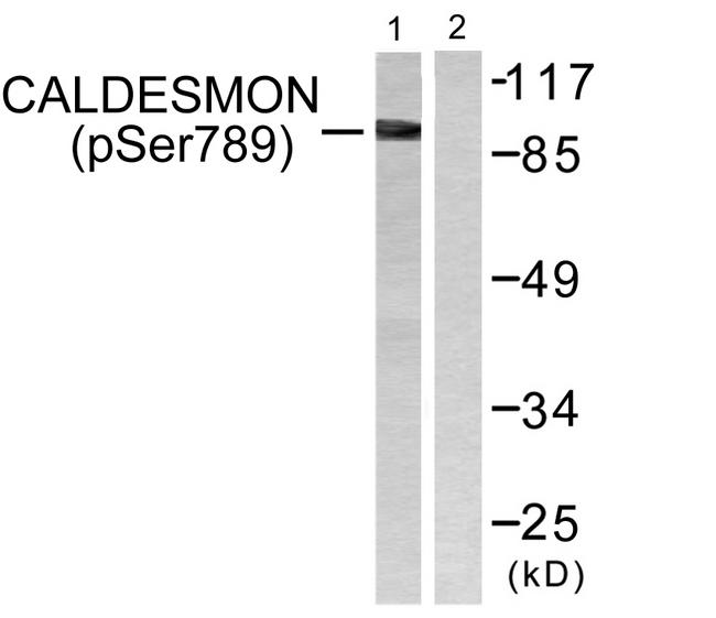 CALD1 / Caldesmon Antibody - Western blot analysis of extracts from HeLa cells, treated with EGF (200ng/ml, 30mins), using Caldesmon (Phospho-Ser789) antibody.