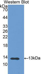 Calgizzarin / S100A11 Antibody