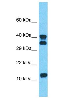 Calgizzarin / S100A11 Antibody - Calgizzarin / S100A11 antibody Western Blot of 721_B. Antibody dilution: 1 ug/ml.  This image was taken for the unconjugated form of this product. Other forms have not been tested.