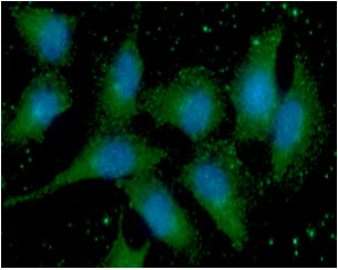 Calgizzarin / S100A11 Antibody - ICC/IF analysis of S100A11 in A549 cells line, stained with DAPI (Blue) for nucleus staining and monoclonal anti-human S100A11 antibody (1:100) with goat anti-mouse IgG-Alexa fluor 488 conjugate (Green).