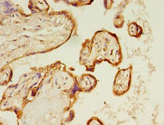 Calgizzarin / S100A11 Antibody - Immunohistochemistry of paraffin-embedded human placenta tissue using antibody at 1:100 dilution.