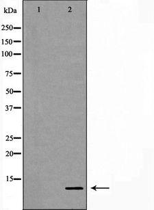 Calgizzarin / S100A11 Antibody - Western blot analysis of LOVO cells cell lysates using S100A11 antibody. The lane on the left is treated with the antigen-specific peptide.