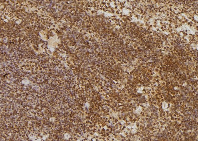 Calgizzarin / S100A11 Antibody - 1:100 staining mouse spleen tissue by IHC-P. The sample was formaldehyde fixed and a heat mediated antigen retrieval step in citrate buffer was performed. The sample was then blocked and incubated with the antibody for 1.5 hours at 22°C. An HRP conjugated goat anti-rabbit antibody was used as the secondary.