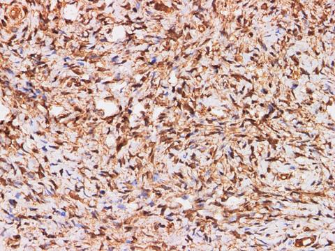 Calgizzarin / S100A11 Antibody - Immunohistochemistry of paraffin-embedded Human ovary using S100A11 Polyclonal Antibody at dilution of 1:200.