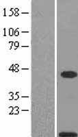 Calgizzarin / S100A11 Protein - Western validation with an anti-DDK antibody * L: Control HEK293 lysate R: Over-expression lysate