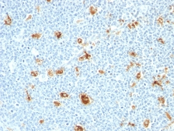 Calgranulin A/B Antibody - Formalin-fixed, paraffin-embedded human tonsil stained with Calgranulin A + B antibody (CAGB/426).  This image was taken for the unmodified form of this product. Other forms have not been tested.