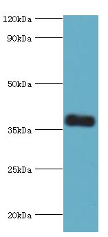 CALHM1 Antibody - Western blot. All lanes: Calcium homeostasis modulator protein 1 antibody at 7 ug/ml+mouse liver tissue. Secondary antibody: Goat polyclonal to rabbit at 1:10000 dilution. Predicted band size: 38 kDa. Observed band size: 38 kDa.