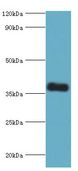 CALHM1 Antibody - Western blot. All lanes: Calcium homeostasis modulator protein 1 antibody at 7 ug/ml+mouse liver tissue. Secondary antibody: Goat polyclonal to rabbit at 1:10000 dilution. Predicted band size: 38 kDa. Observed band size: 38 kDa.