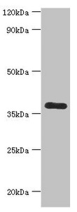 CALHM1 Antibody - Western blot All lanes: Calcium homeostasis modulator protein 1 antibody at 7µg/ml + Mouse liver tissue Secondary Goat polyclonal to rabbit IgG at 1/10000 dilution Predicted band size: 38 kDa Observed band size: 38 kDa