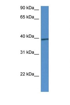 CALHM1 Antibody - CALHM1 antibody Western blot of Mouse Intestine lysate. Antibody concentration 1 ug/ml.  This image was taken for the unconjugated form of this product. Other forms have not been tested.