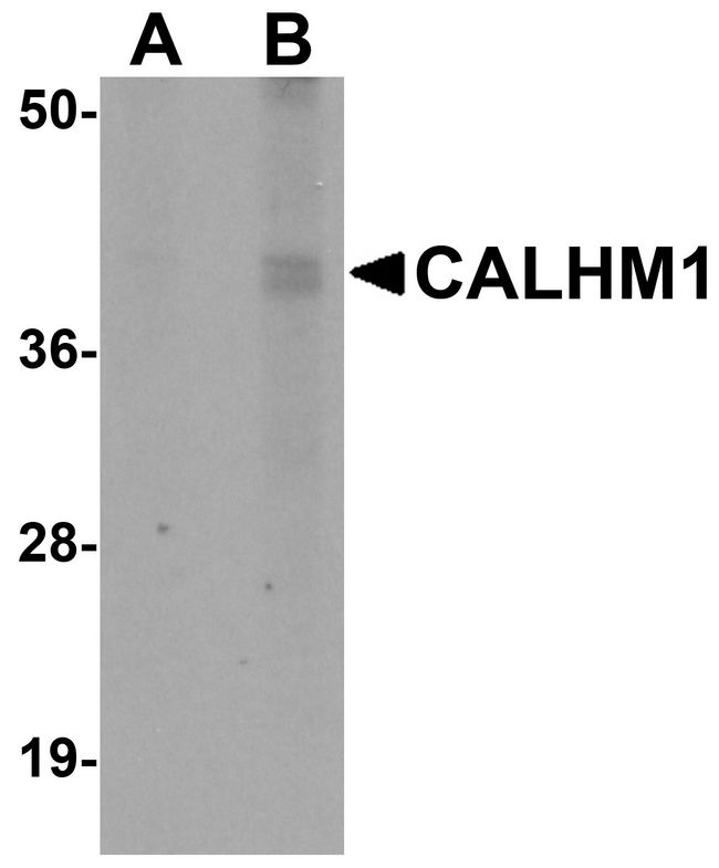 CALHM1 Antibody - Western blot analysis of CALHM1 in rat liver tissue lysate with CALHM1 antibody at (A) 1 and (B) 2 ug/ml.