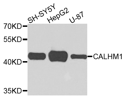 CALHM1 Antibody - Western blot analysis of extracts of various cells.