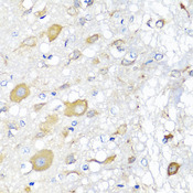 CALHM1 Antibody - Immunohistochemistry of paraffin-embedded rat brain tissue.