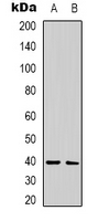 CALHM1 Antibody - Western blot analysis of CALHM1 expression in human brain (A); rat brain (B) whole cell lysates.