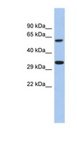CALHM3 Antibody - CALHM3 antibody Western blot of Fetal liver lysate. This image was taken for the unconjugated form of this product. Other forms have not been tested.