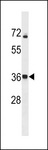 CALHM3 Antibody - CALHM3 Antibody western blot of A2058 cell line lysates (35 ug/lane). The CALHM3 antibody detected the CALHM3 protein (arrow).