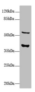 CALHM3 Antibody - Western Blot All lanes: CALHM3 antibody at 8µg/ml + Mouse kidney tissue Secondary Goat polyclonal to rabbit IgG at 1/10000 dilution Predicted band size: 40, 39 kDa Observed band size: 40, 55 kDa