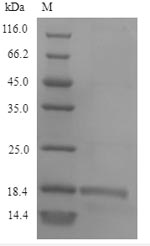 SLYA Protein - (Tris-Glycine gel) Discontinuous SDS-PAGE (reduced) with 5% enrichment gel and 15% separation gel.