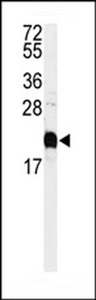 CALM1 / Calmodulin Antibody - Western blot of anti-Calmodulin Antibody in HeLa cell line lysates (35 ug/lane). Calmodulin(arrow) was detected using the purified antibody.