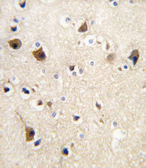 CALM1 / Calmodulin Antibody - Formalin-fixed and paraffin-embedded human brain tissue reacted with Calmodulin antibody , which was peroxidase-conjugated to the secondary antibody, followed by DAB staining. This data demonstrates the use of this antibody for immunohistochemistry; clinical relevance has not been evaluated.