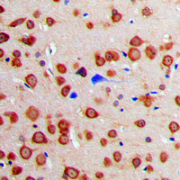 CALM1 / Calmodulin Antibody - Immunohistochemical analysis of Calmodulin staining in human brain formalin fixed paraffin embedded tissue section. The section was pre-treated using heat mediated antigen retrieval with sodium citrate buffer (pH 6.0). The section was then incubated with the antibody at room temperature and detected using an HRP conjugated compact polymer system. DAB was used as the chromogen. The section was then counterstained with hematoxylin and mounted with DPX.
