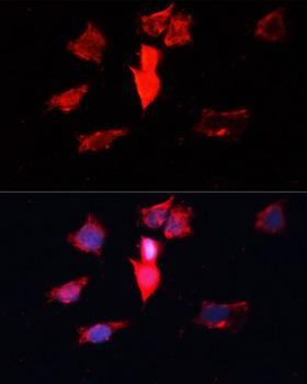 CALM1 / Calmodulin Antibody - Immunofluorescence analysis of HeLa cells using CALM3 Polyclonal Antibody at dilution of 1:100.Blue: DAPI for nuclear staining.