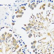 CALM1 / Calmodulin Antibody - Immunohistochemistry of paraffin-embedded Mouse testis using CALM3 Polyclonal Antibody at dilution of 1:100 (40x lens).