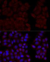 CALM1 / Calmodulin Antibody - Immunofluorescence analysis of HeLa cells using CALM1 Polyclonal Antibody at dilution of 1:100 (40x lens).Blue: DAPI for nuclear staining.