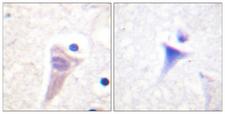 CALM1 / Calmodulin Antibody - P-peptide - + Immunohistochemistry analysis of paraffin-embedded human brain tissue using Calmodulin (Phospho-Thr79+Ser81) antibody.