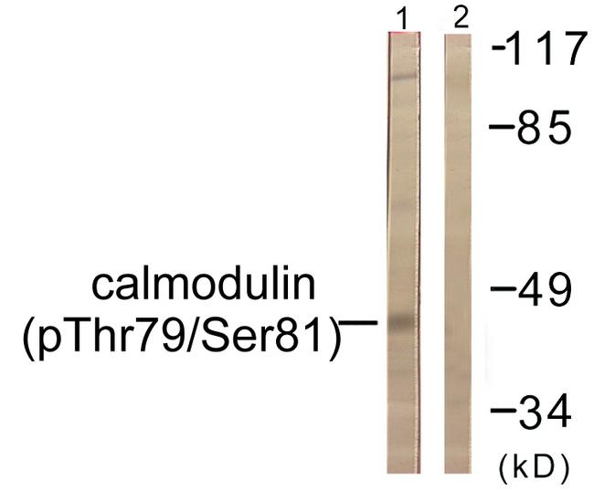 CALM1 / Calmodulin Antibody - Western blot analysis of extracts from Jurkat cells, treated with Insulin (0.01U/ml, 15mins), using Calmodulin (Phospho-Thr79+Ser81) antibody.