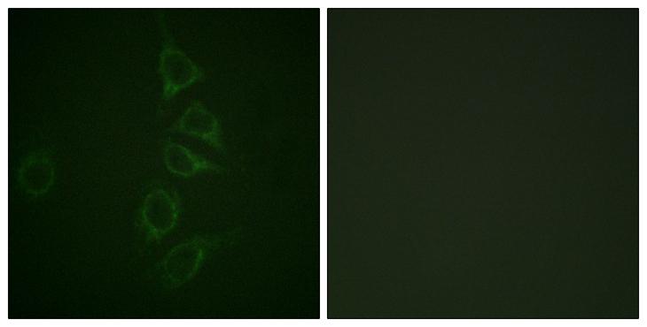 CALM1 / Calmodulin Antibody - P-peptide - + Immunofluorescence analysis of HepG2 cells, using Calmodulin (Phospho-Thr79+Ser81) antibody.